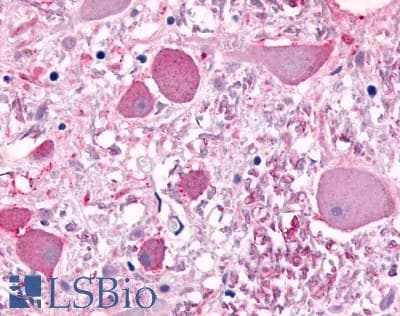 PathPlus™ CELSR1 Antibody (N-Terminus)
