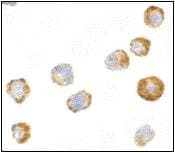 IHC-plus™ Polyclonal Rabbit anti-Human MAP3K5 / ASK1 Antibody (IHC, IF, WB)