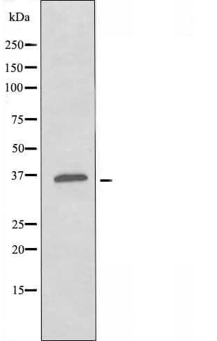 MC4R / Melanocortin 4 Receptor Antibody