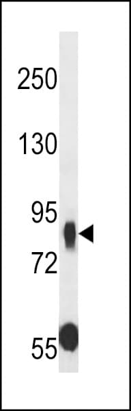 Polyclonal Rabbit anti-Human CDHR5 / MUCDHL Antibody (aa131-160, WB)