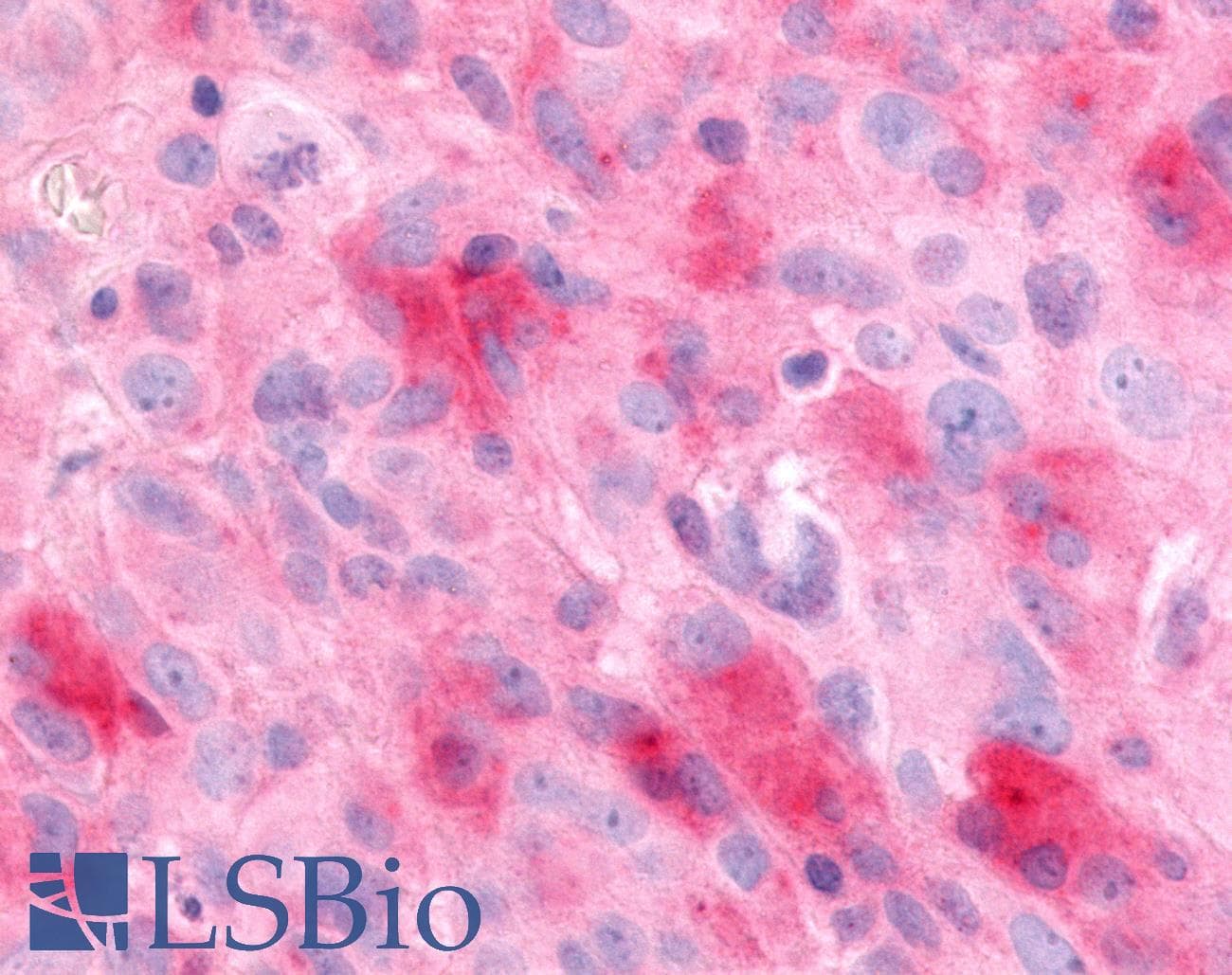 PathPlus™ EAR2 / NR2F6 Antibody (N-Terminus)