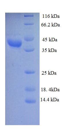 Leuconostoc mesenteroides DLD / Diaphorase / E3 Protein (Recombinant His)