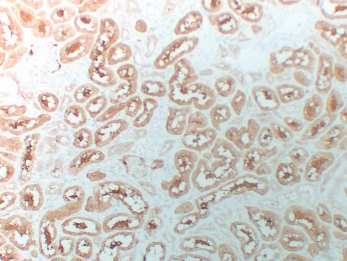 Monoclonal Mouse anti-Human HDAC6 Antibody (clone ABT-HDAC6, IHC)