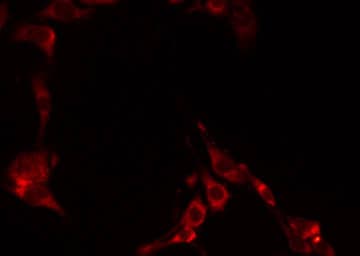 GCNT6 Antibody