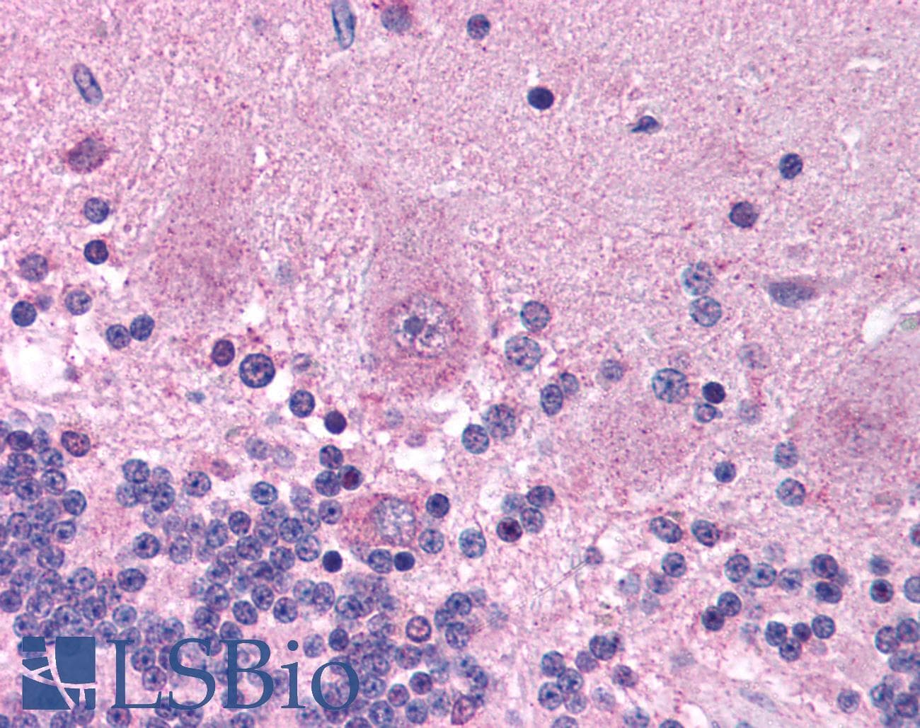Polyclonal Rabbit anti-Human KCNAB2 / Kv-Beta-2 Antibody (aa121-170, IHC, WB)