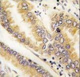 AGR2 Antibody (aa13-42)