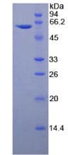 Rat THBS4 / Thrombospondin 4 Protein (Recombinant His-GST)