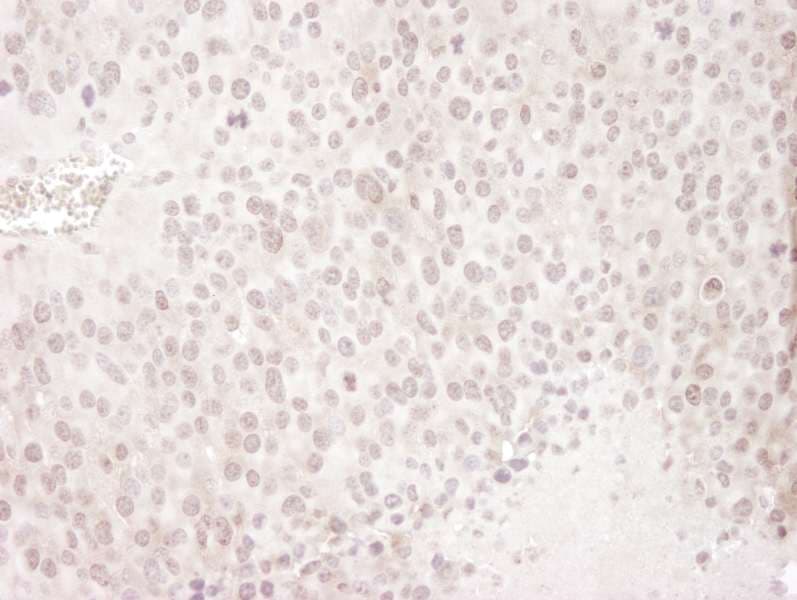 GEMIN4 Antibody (aa1010-C-term)