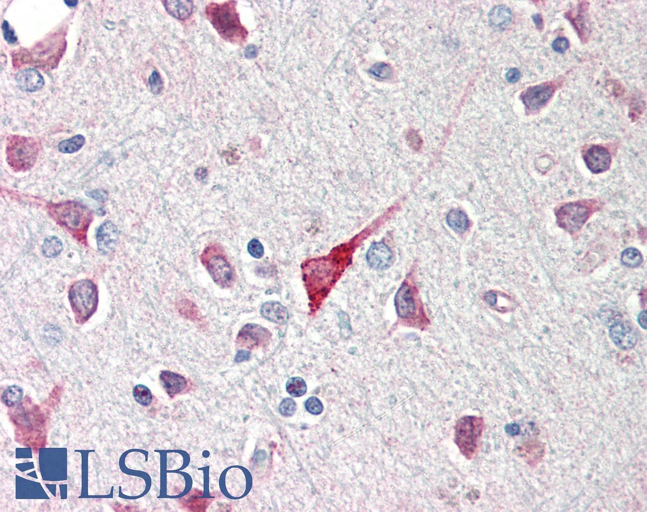 IHC-plus™ C1QTNF5 / CTRP5 Antibody