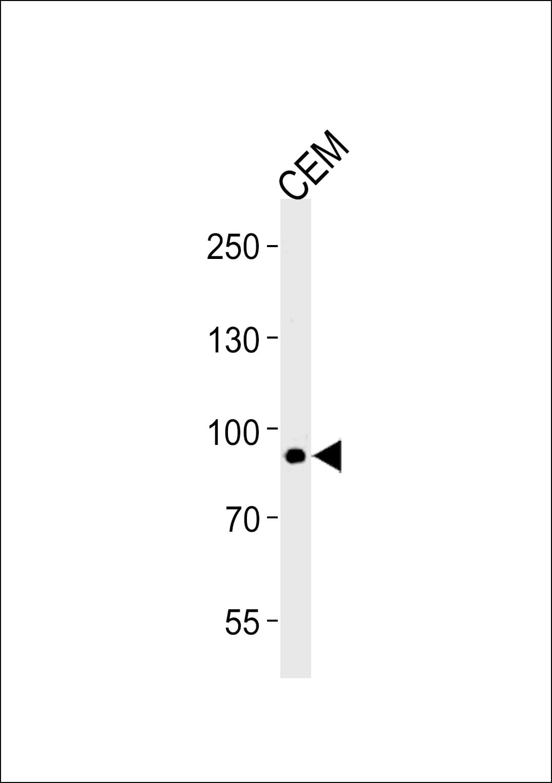 Polyclonal Rabbit anti-Human MATN2 / Matrilin 2 Antibody (aa732-760, WB)