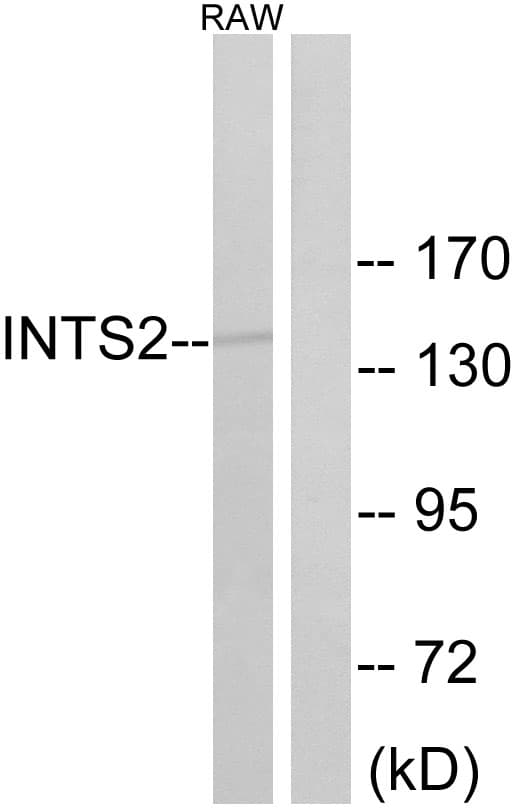 IHC-plus™ INTS2 / INT2 Antibody (aa201-250)