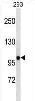 Polyclonal Rabbit anti-Human KCNB2 / Kv2.2 Antibody (aa138-166, WB)