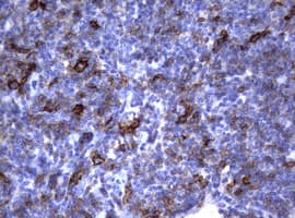 FCER2 / CD23 Antibody (clone OTI2B6)