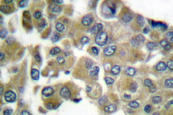 KRT16 / CK16 / Cytokeratin 16 Antibody (Ser451)