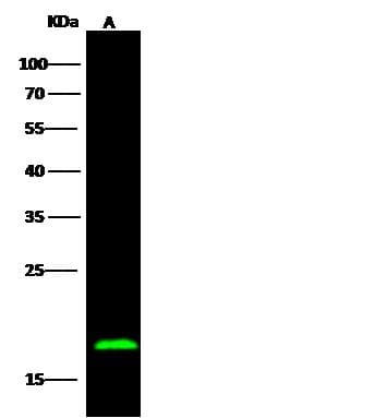 Polyclonal Rabbit anti-Human S100B / S100 Beta Antibody (Preservative Free, IHC, WB)