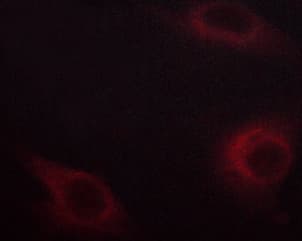 Polyclonal Rabbit anti-Human NFKBIE / IKB Epsilon Antibody (phospho-Ser22, IHC, IF, WB)