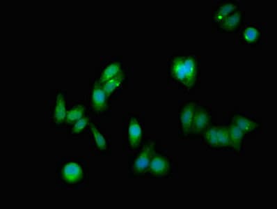 NOTCH1 Antibody