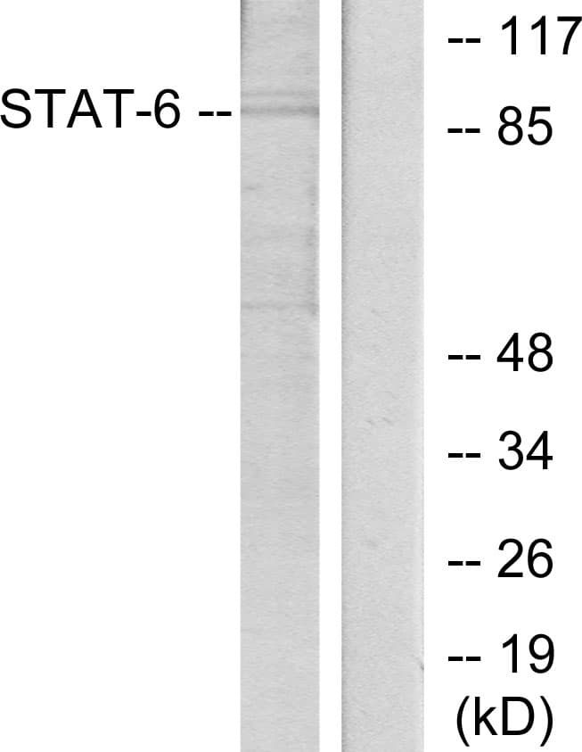 STAT6 Antibody (aa612-661)