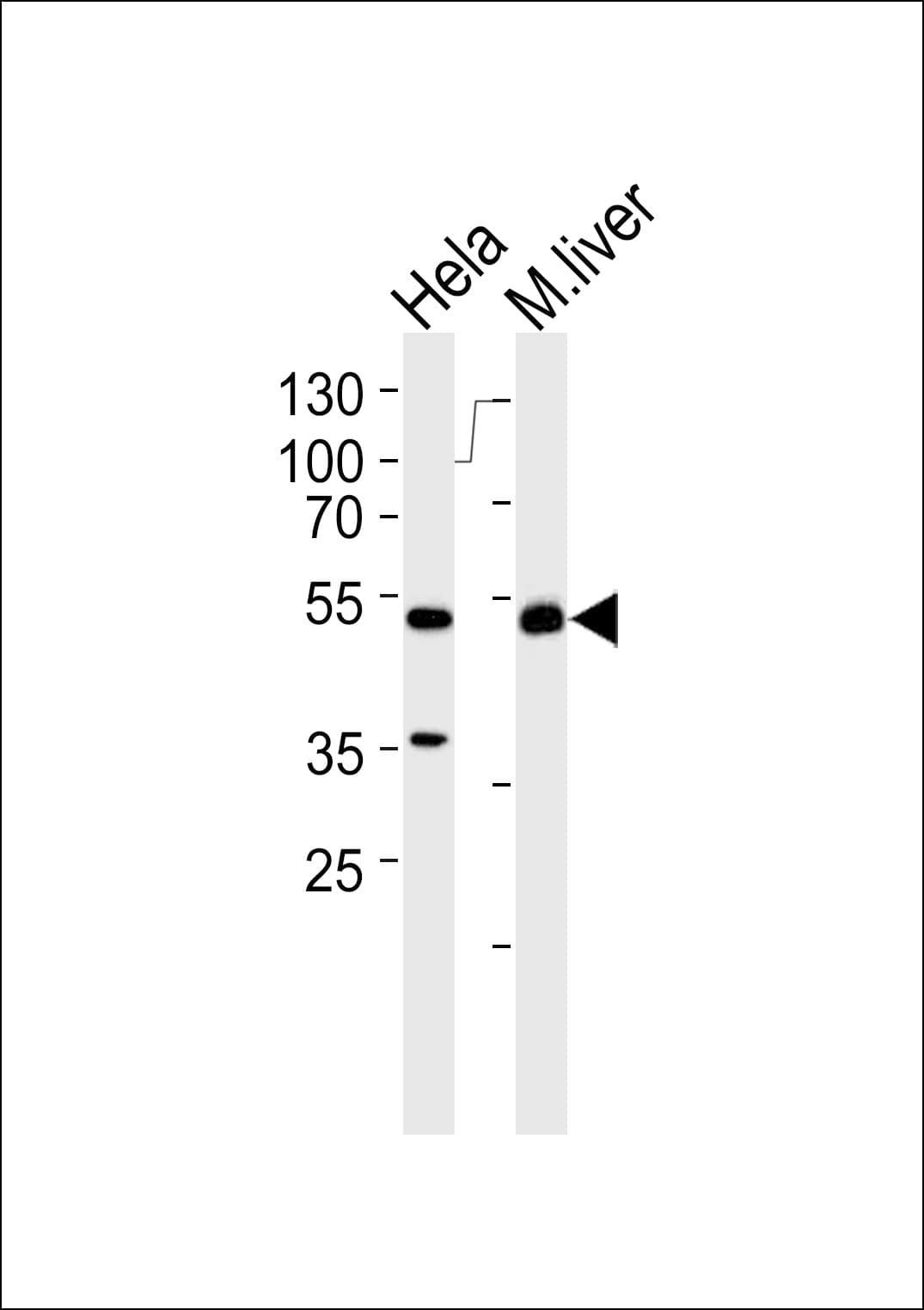 AUTL1 / ATG4C Antibody (aa419-448)