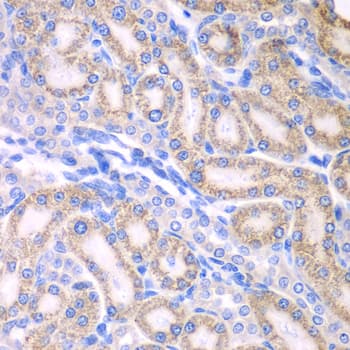 RALDH2 / ALDH1A2 Antibody