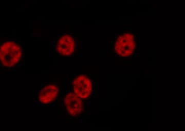 Polyclonal Rabbit anti-Human EFTUD2 Antibody (IHC, IF, WB)