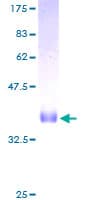 Human CORNIFIN / SPRR1B Protein (Recombinant GST)