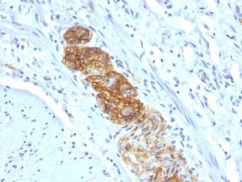 NCAM / CD56 Antibody (clone NCAM1/784)