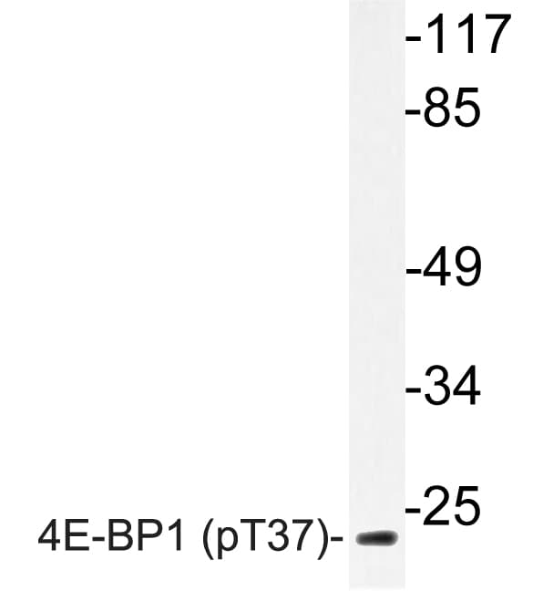 EIF4EBP1 / 4EBP1 Antibody (phospho-Thr37)
