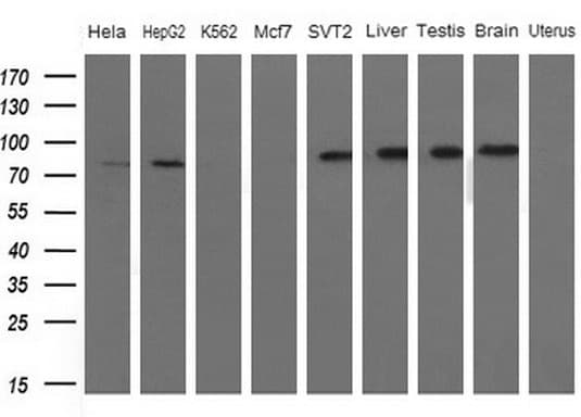 FARSB Antibody (clone OTI4B3)
