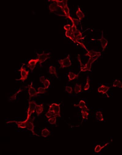 IGF1R / IGF1 Receptor Antibody (phospho-Tyr1165,pTyr1166)