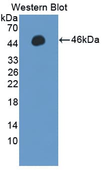 PPM1A / PP2CA Antibody (aa2-382)