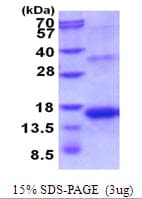 Human INHBA / Inhibin Beta A Protein (Recombinant His)