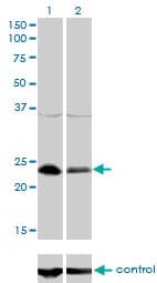 NFYB Antibody (clone 6H6)