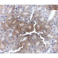 AP50 / AP2M1 Antibody