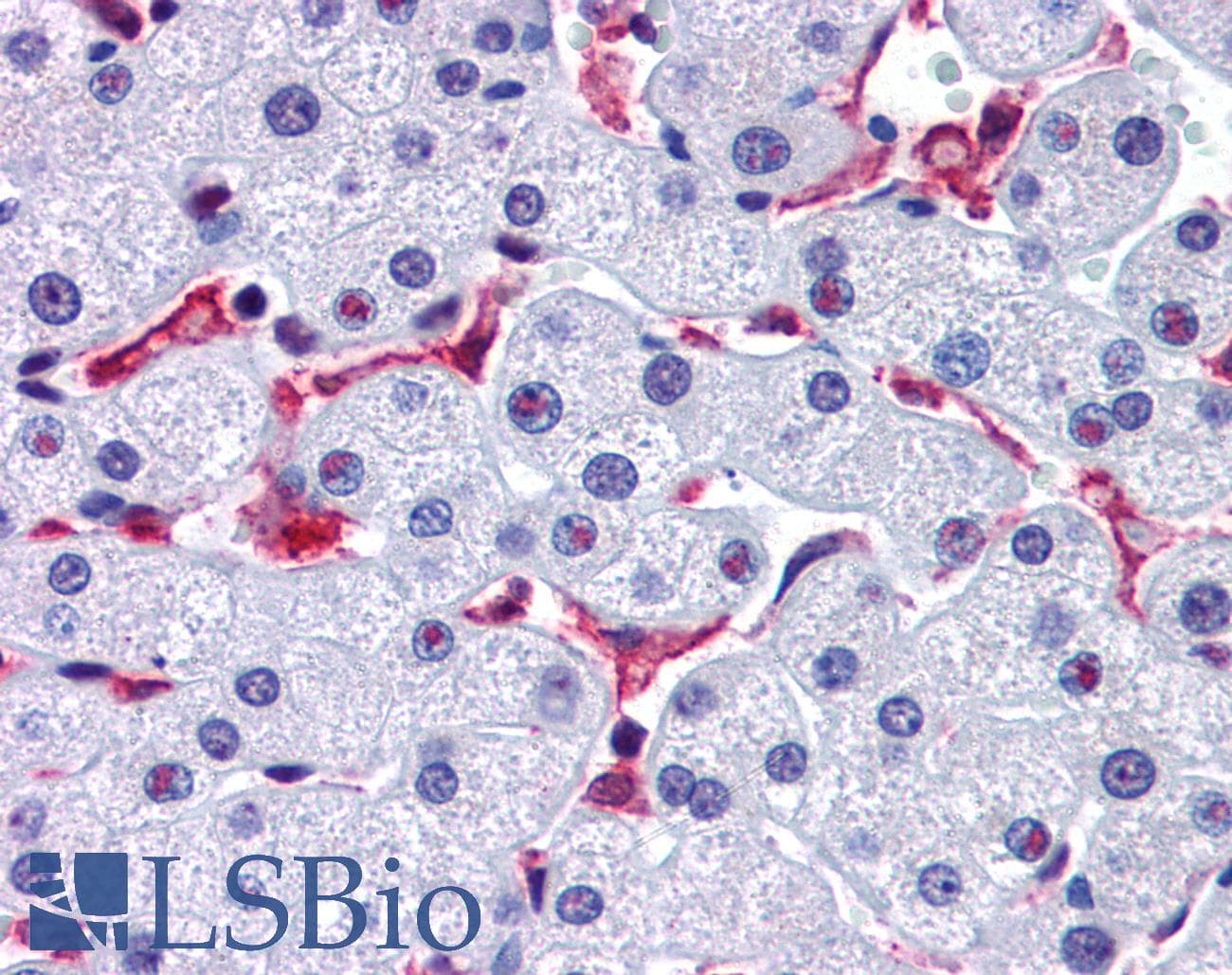 IHC-plus™ Prominin 2 / PROM2 Antibody (Internal)