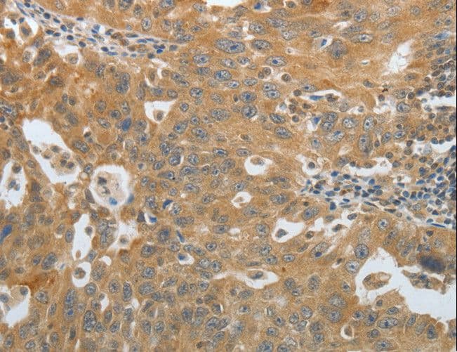 AMPH / Amphiphysin Antibody