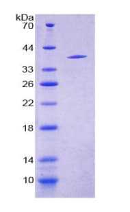 Human Neuropeptide S / NPS Protein (Recombinant His-GST)
