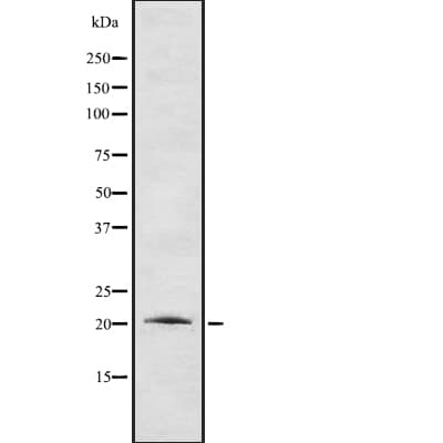 CTF1 / Cardiotrophin-1 Antibody (aa43-71)