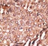 Polyclonal Rabbit anti-Human BAIAP2 / IRSP53 Antibody (aa492-518, IHC, WB)