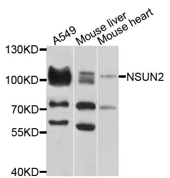 Polyclonal Rabbit anti-Human NSUN2 Antibody (WB)