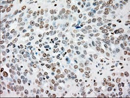 SSB / La Antibody (clone OTI2C8)