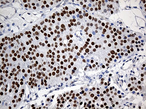 Monoclonal Mouse anti-Human ZKSCAN1 / ZNF36 Antibody (clone OTI3C4, IHC, WB)