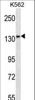 MN1 Antibody (aa835-864)