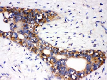 Polyclonal Rabbit anti-Human AGTR1 / AT1 Receptor Antibody (IHC, WB)