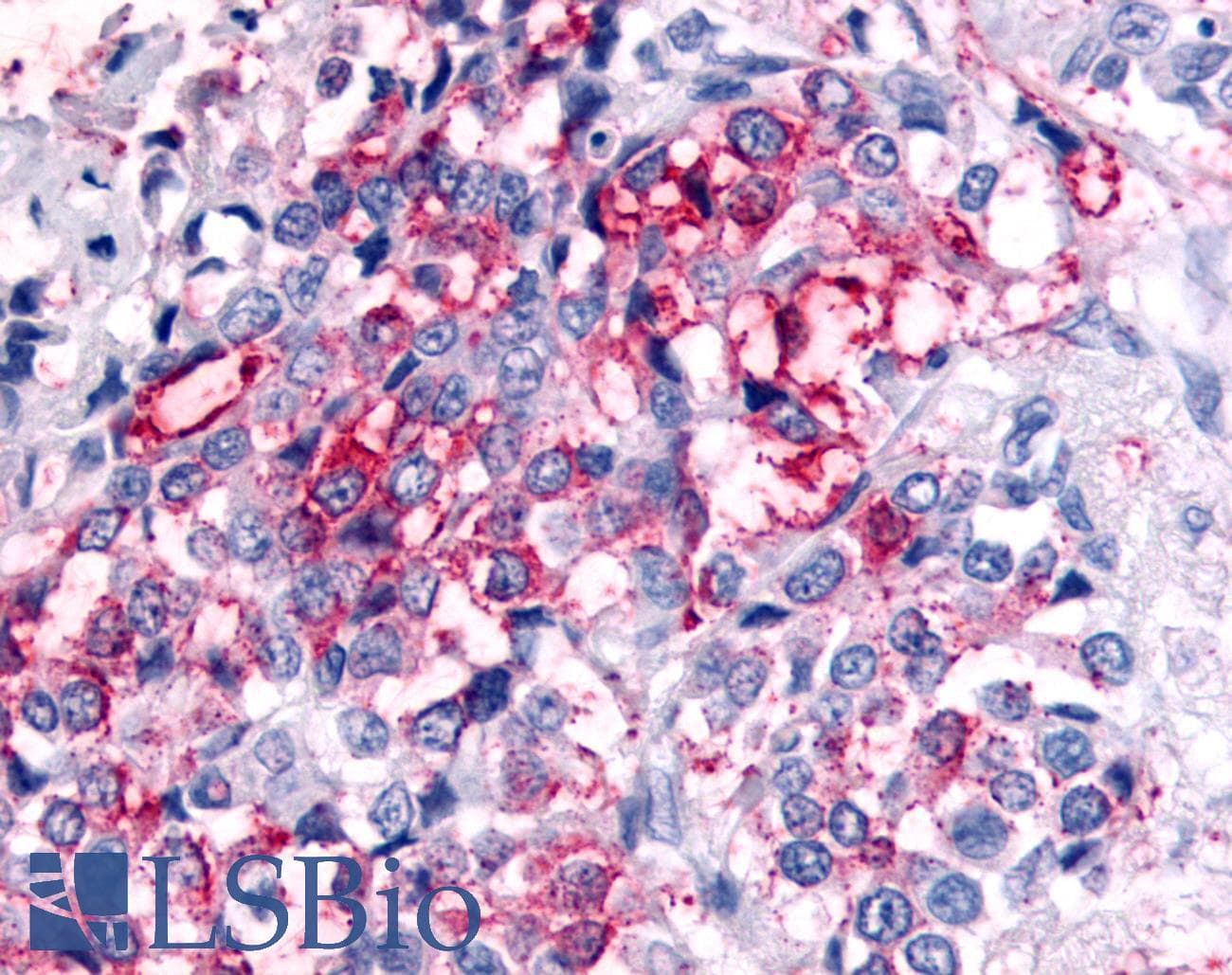 PathPlus™ Polyclonal Rabbit anti-Human PRKD2 / PKD2 Antibody (Internal, IHC)