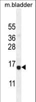 CHIC2 Antibody (aa138-165)