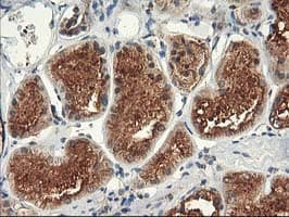 TFG Antibody (clone OTI2C3)