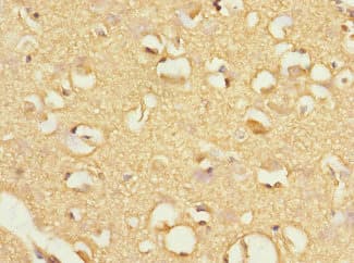 Polyclonal Rabbit anti-Human FBXO4 / FBX4 Antibody (IHC)