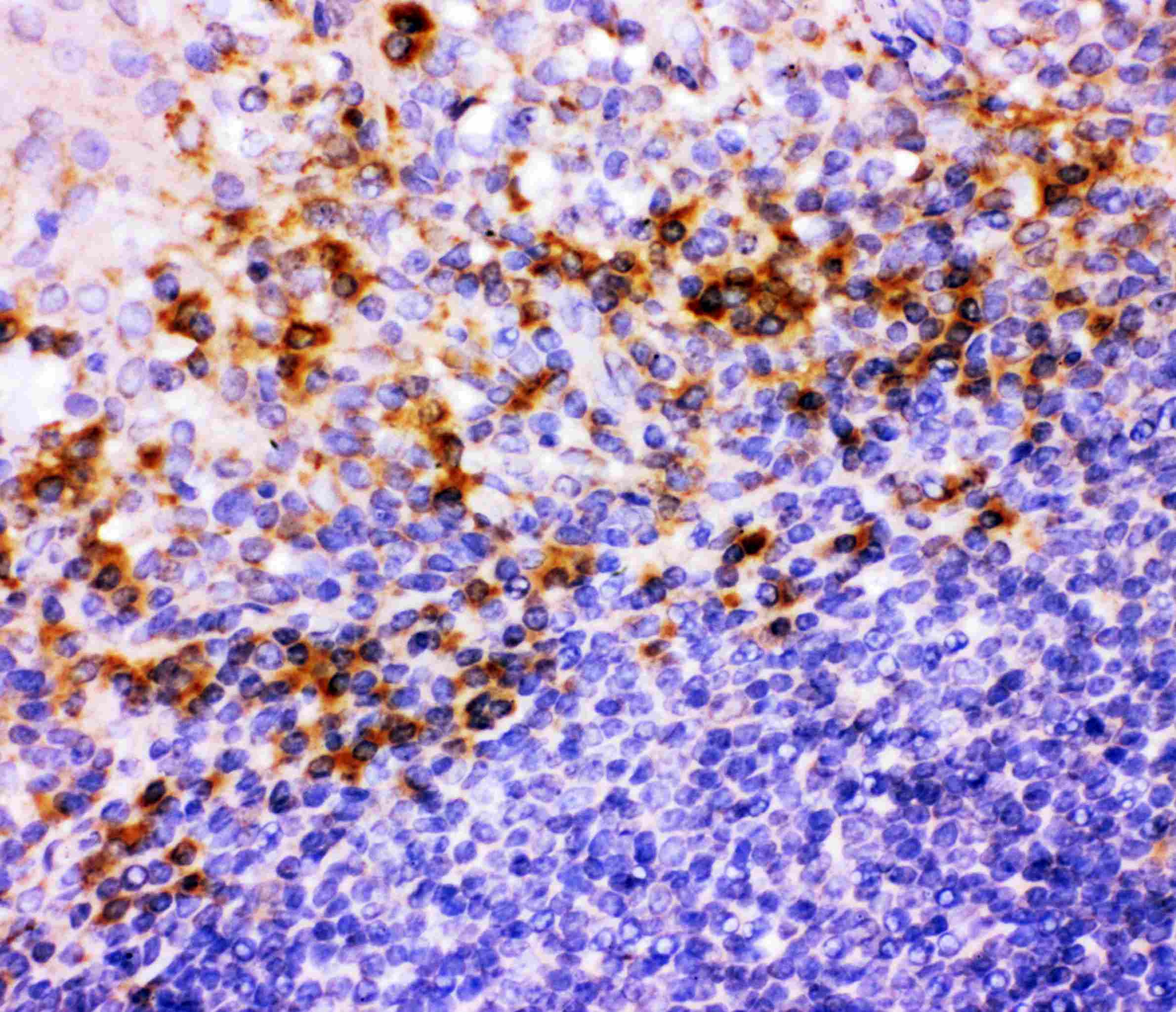 Polyclonal Rabbit anti-Human ITGB1 / Integrin Beta 1 / CD29 Antibody (aa527-728, IHC, WB)