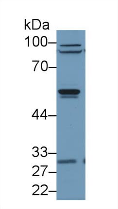 ARRB2 / Beta Arrestin 2 Antibody (aa262-430)
